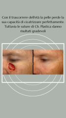 Chirurgia oncologica