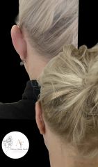 Dott.ssa Arianna Franchi Otoplastica