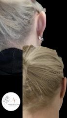 Dott.ssa Arianna Franchi Otoplastica