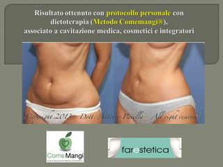 dieta e cavitazione addome prima dopo