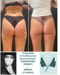 EMBODY - DVClinic
