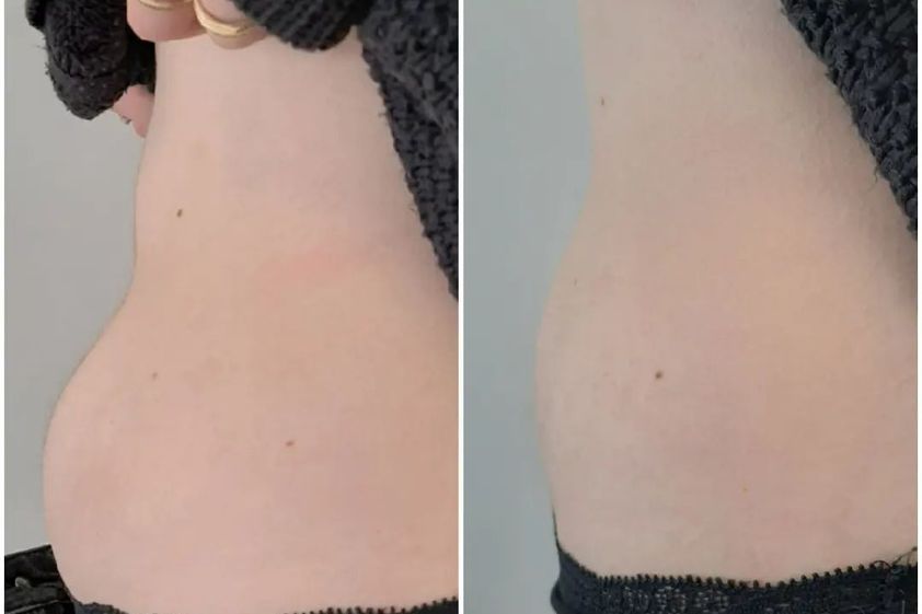 Dieta prima e dopo - 841822
