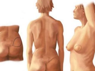 Plastic Surgery