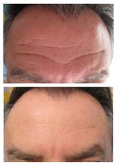 Dott.ssa Solomon Lia botulino