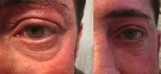 Dott.ssa Solomon Lia occhiaie e zona perioculare