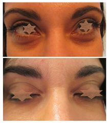 Dott.ssa Solomon Lia eliminare occhiaie