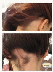 Dott.ssa Solomon Lia perdita dei capelli