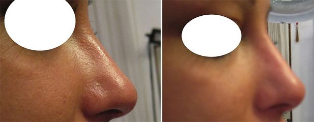 Dott.ssa Solomon Lia Rinofiller