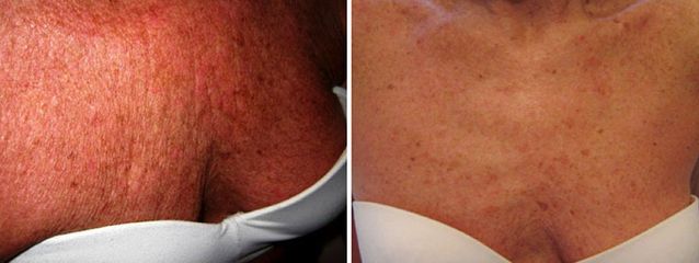 Dott.ssa Solomon Lia ringiovanimento