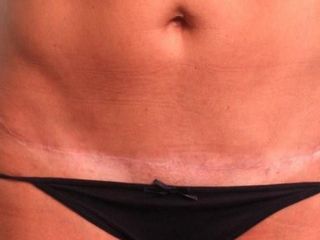 Plastic Surgery