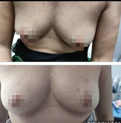 Macchie della pelle - Dott.ssa Chiara Cassano