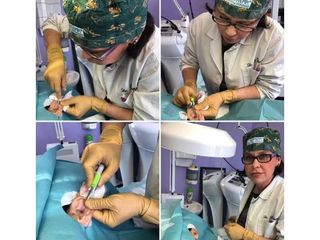 Otoplastica