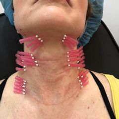 Dott.ssa Olena Nazarko - DioDent Clinic
