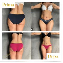 Intralinoterapia - Dott.ssa Simona Pomarico