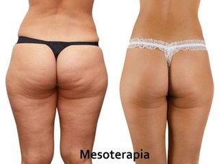 ManaraSalus