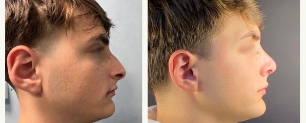 Dr. Roberto Loche Rinoplastica