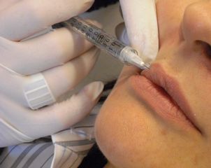 filler labiale