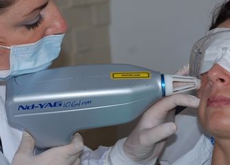Laser Nd-Yag vascolare 