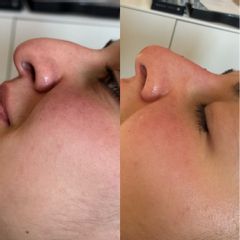 Studio Medico Ametìs Dott.ssa Elena Vescovi Rinofiller