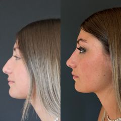 Studio Medico Ametìs Dott.ssa Elena Vescovi Rinofiller