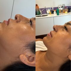Studio Medico Ametìs Dott.ssa Elena Vescovi Riarmonizzazione del profilo