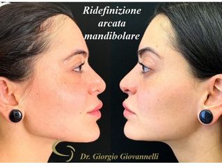 Arcata mandibolare - Dr. Giorgio Giovannelli