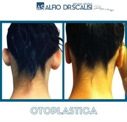 Otoplastica - Dott. ALFIO SCALISI - 4 Spa Medical Clinic