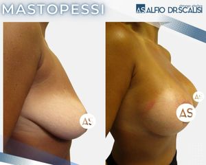 Dott. Alfio Scalisi - 4 Spa Medical Clinic Mastopessi