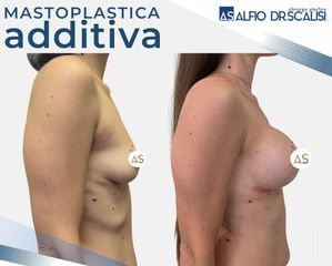 Dott. Alfio Scalisi - 4 Spa Medical Clinic Mastoplastica Additiva