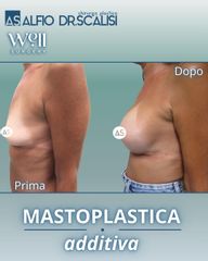 Dott. Alfio Scalisi - 4 Spa Medical Clinic Mastoplastica Additiva