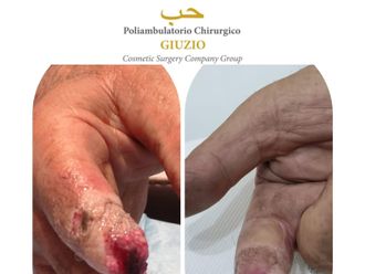 Chirurgia ricostruttiva prima e dopo - 871689