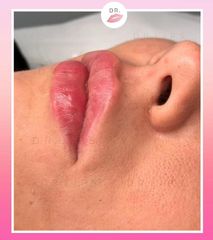 Dr. Lips