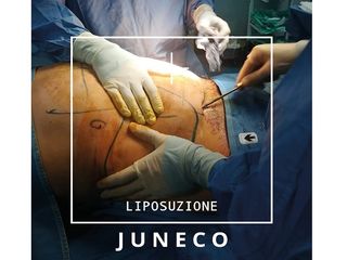 Juneco Cliniche di Medicina e Chirurgia Estetica