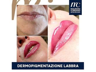 Dermopigmentazione - 800347