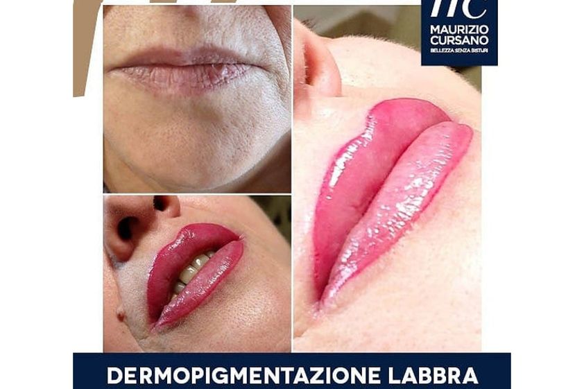 Dermopigmentazione prima e dopo - 800347