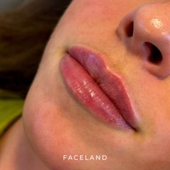 Faceland Filler Labbra