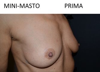 Mini masto pre