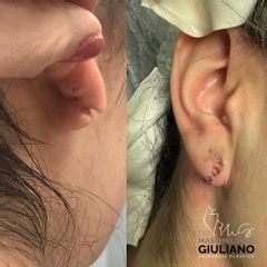 Prof. Dott. Massimiliano Giuliano Chirurgia Ricostruttiva