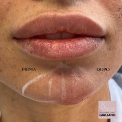 Prof. Dott. Massimiliano Giuliano Filler