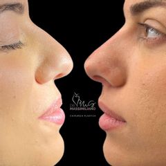 Prof. Dott. Massimiliano Giuliano Rinofiller