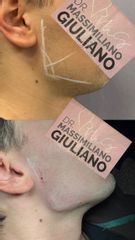 Prof. Dott. Massimiliano Giuliano Profilo angolo mandibolare