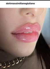 Prof. Dott. Massimiliano Giuliano filler labbra