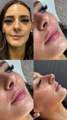 Prof. Dott. Massimiliano Giuliano Simmetrizzazione