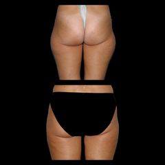 culotte de cheval prima dopo