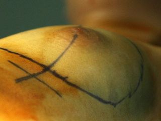 Chirurgia Plastica Piemonte