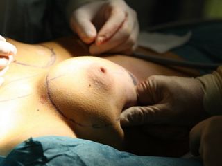 Chirurgia Plastica Piemonte