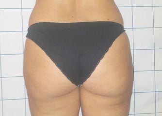 Dottssa Anna Calandro
