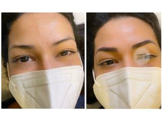 Microblading - MEB Medicina estetica e Benessere