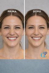 Dott. Giovanni Portaluri Botulino