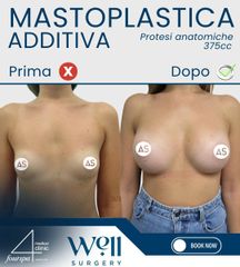 Well Surgery Matoplastica Additiva